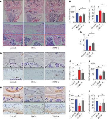 Dual protective role of velutin against articular cartilage degeneration and subchondral bone loss via the p38 signaling pathway in murine osteoarthritis